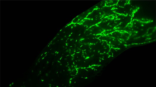 Fluorescence stereo micrograph of a mouse mammary gland intraductally injected with normal human breast epithelial cells © Marie Shamseddin / EPFL