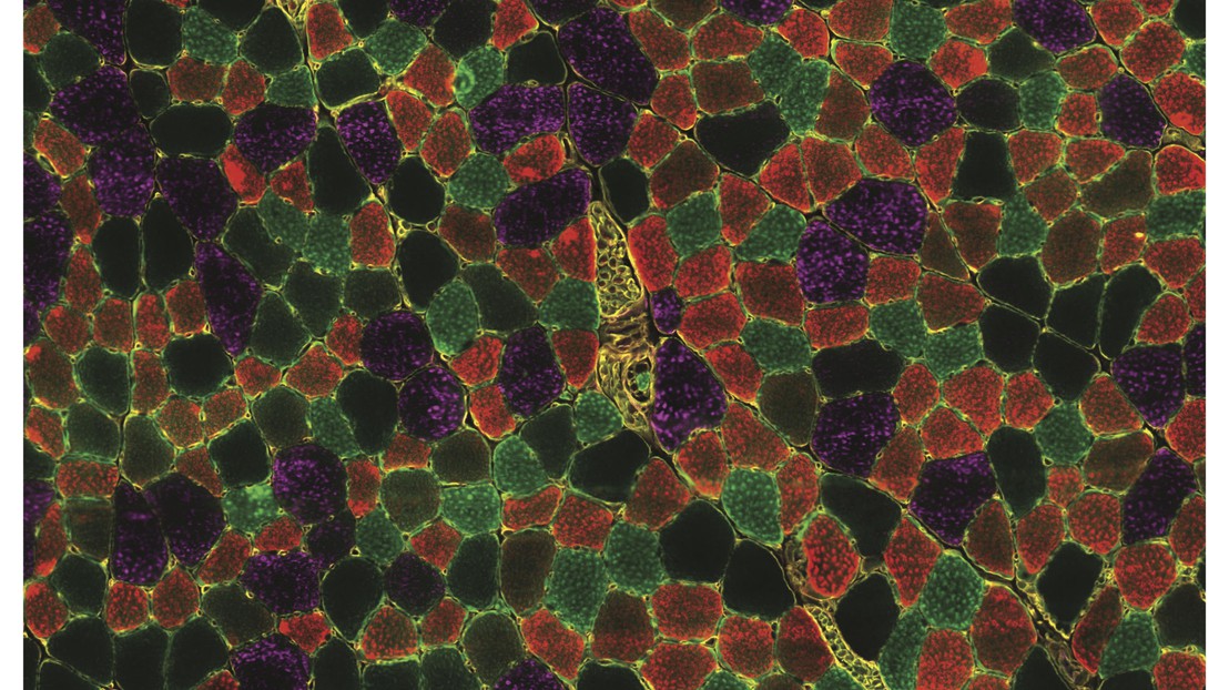 Staining of a skeletal muscle cross-section showing different types of muscle fiber in young mice. Credit: Martin Wohlwend