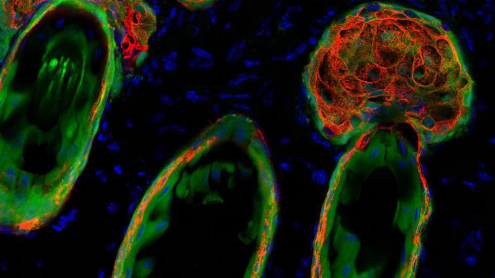 Rat thymic epithelial cells (green) contributing to hair follicles and sebaceous glands Rat thymic epithelial cells (green) contributing to hair follicles and sebaceous glands