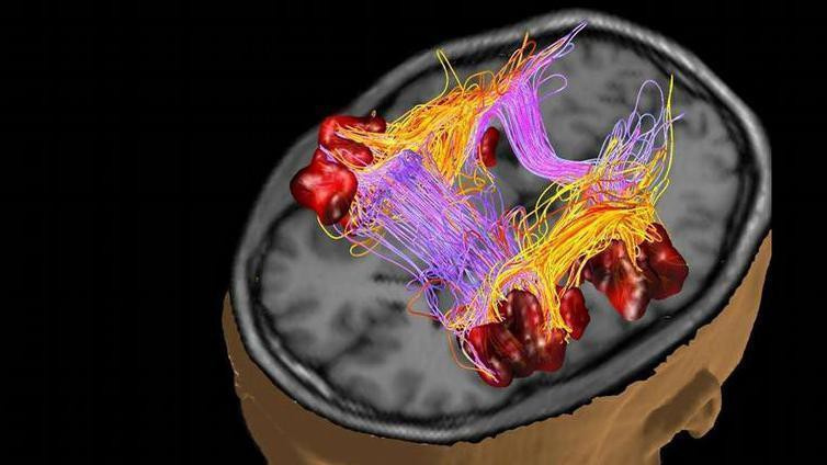 Brain fibers connecting language areas (c) EPFL